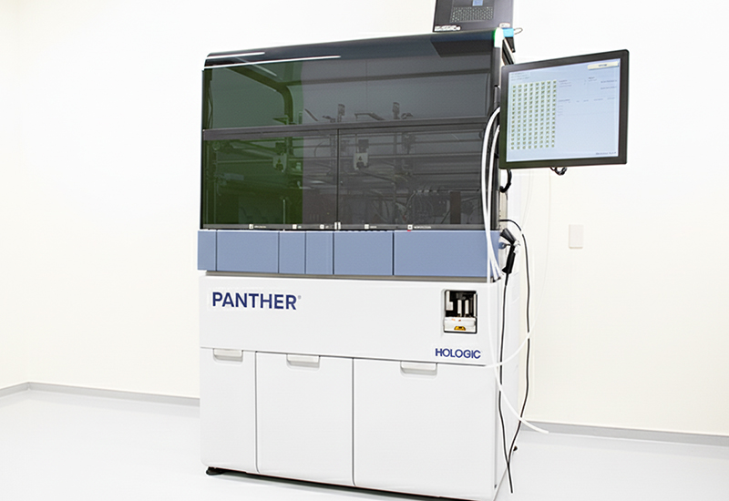 性感染症検査（STD）